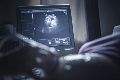 The Journey of Ultrasound Technology: From Fundamental to Advanced