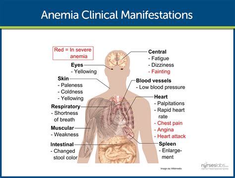 The Physical Manifestation: Could There Be a Medical Explanation?