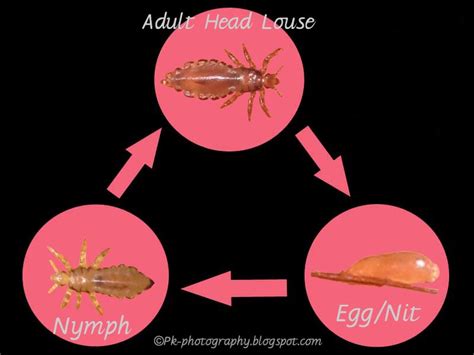 The Possible Connections between Head Lice Eggs and Real-Life Situations