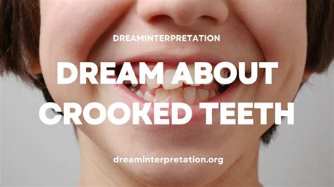 The Psychological Significance of Dreams featuring Misaligned Teeth