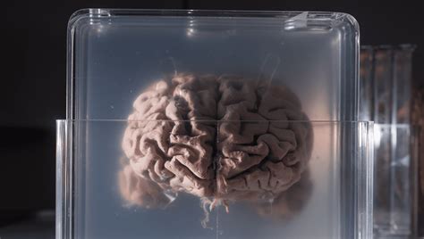 The Science Behind Cerebral Transplants