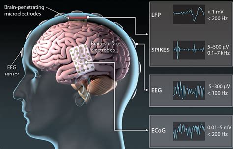 The Science Behind Electromagnetic Dreaming: Decoding the Brain's Electrical Activity