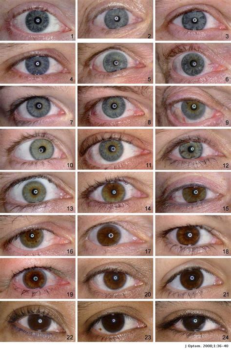 The Science Behind the Variation of Iris Pigmentation