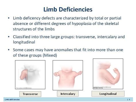 The Significance of Fantasizing About a Lost Limb