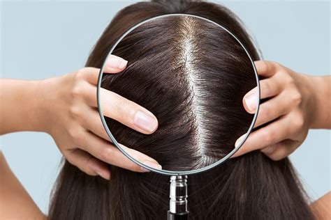 The Significance of Scalp Health for Hair Growth