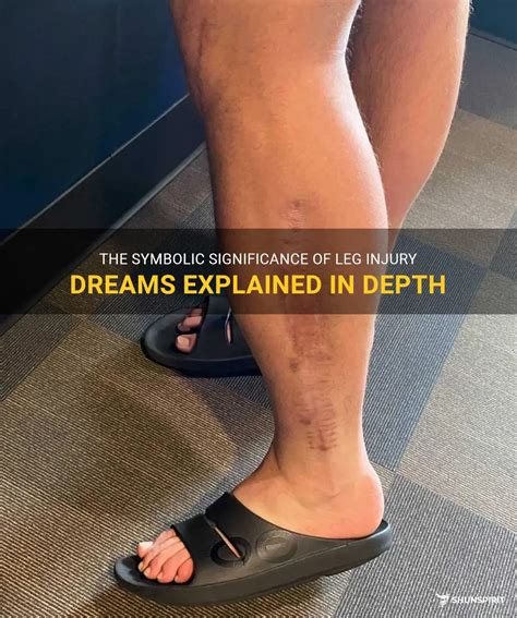 The Significance of the Left Leg in Dreams