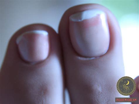 The Symbolic Significance of Extracting Toenails in the Realm of Dream Interpretation