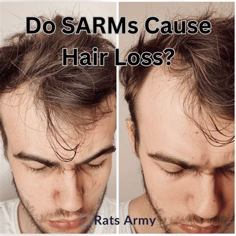 The Truth Revealed: Uncovering the Causes of Hair Loss and Effective Measures to Prevent It