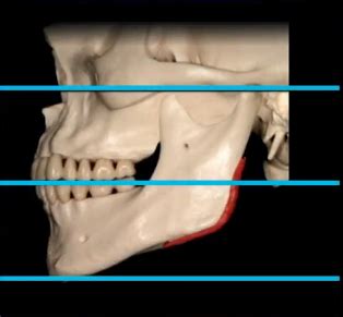 The Vertical Dimension: How Elevated is She?