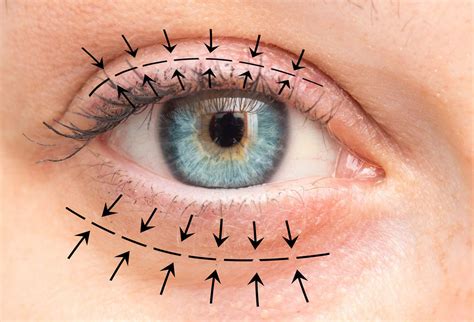 Tips and Techniques for Enhancing Eyelid Alignment to Facilitate Optimal Sleep