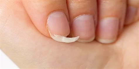 Tips to Avoid Acrylic Nail Fractures