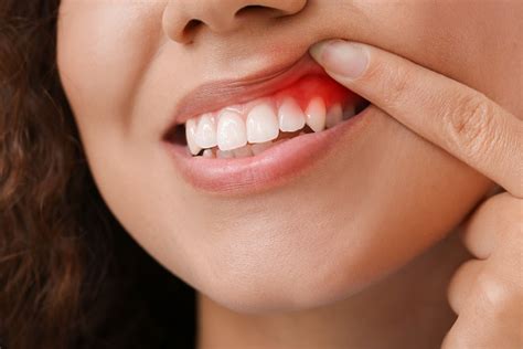 Understanding Gum Infections: Vital Knowledge for Dental Health