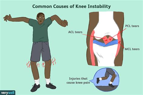 Understanding Weak Knees: What They Indicate and Why They Occur