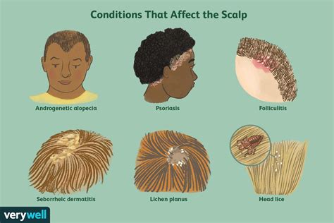 Understanding the Condition of a Crimson Scalp: What Triggers it?