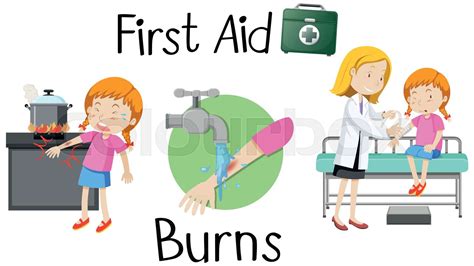 Understanding the Essential First Aid for Burns