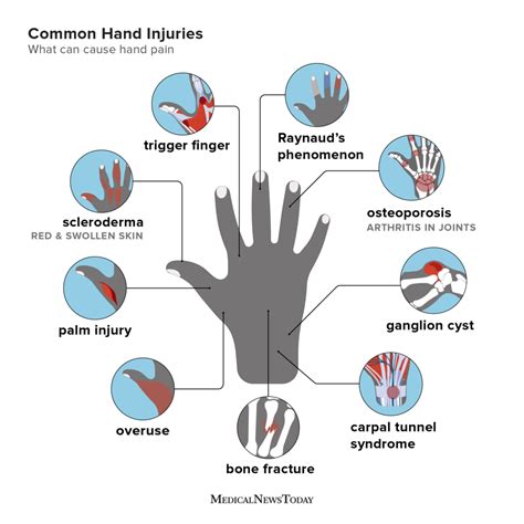 Understanding the Psychological Interpretation of Thumb Injuries