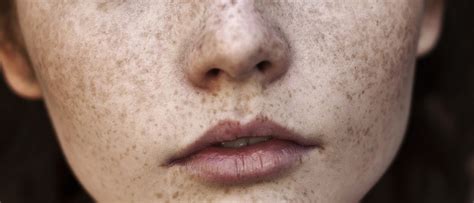 Unlocking the Mysteries Behind Freckles' Stature