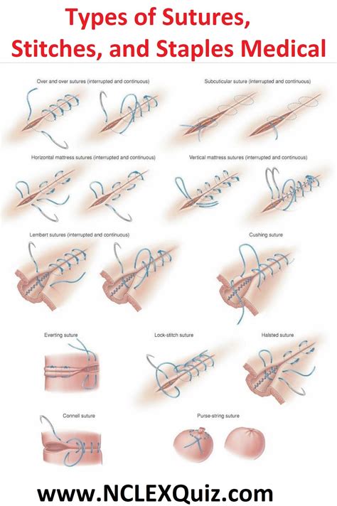 Unraveling the Significance of Mouth Sutures: Deciphering their Symbolic Meanings