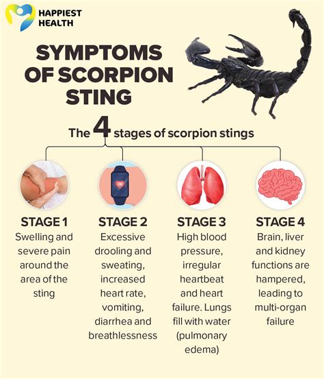 Unraveling the Significance of Scorpions Present on the Palm of One's Hand in Oneiric Manifestations