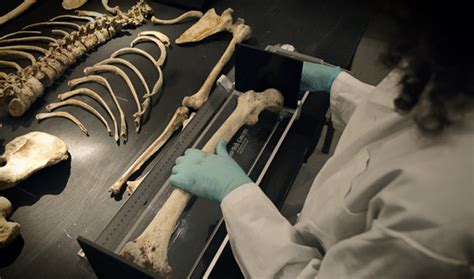 Unveiling the Secrets: Forensic Anthropology and the Analysis of Bones