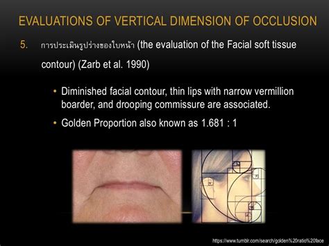 Vertical Dimension and Physical Appearance