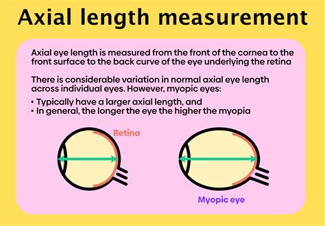 Vertical Measurement: Unveil the Elongation of Abby's Stature