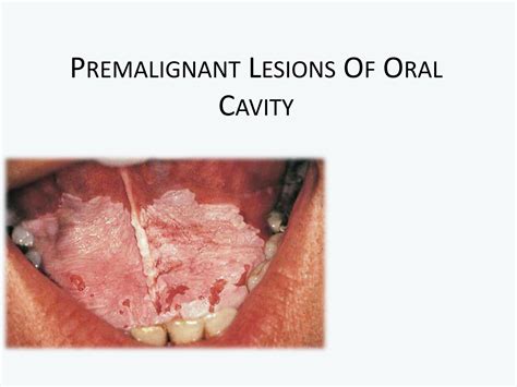 When to Seek Medical Attention for Lesions in the Oral Cavity During Sleep