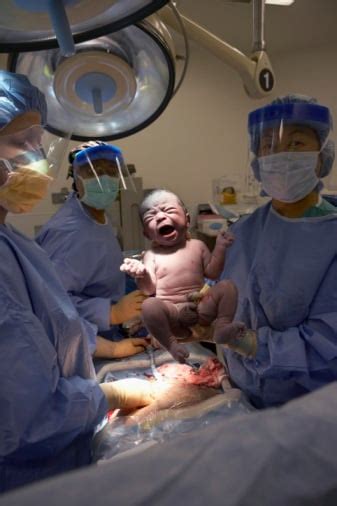 Why Some Women Prefer C-Sections over Natural Birth