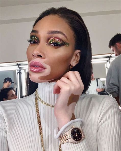 Winnie Harlow's Beauty Tips and Secrets